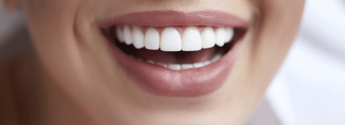 dents parfaitement alignées