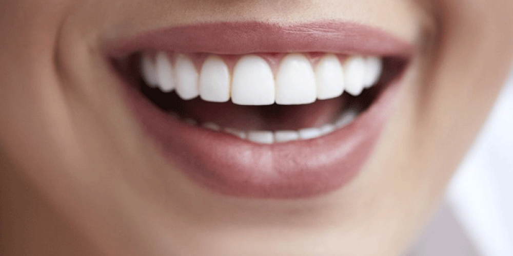 Comment avoir des dents parfaitement alignées ?